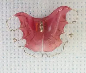różowy aparat dla dziecka Schwarca, druciki na zęby na sztucznym podniebieniu