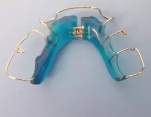 aparat Schwarca jednoszczękowy niebieski druciki na zęby na wąskim szkielecie 
