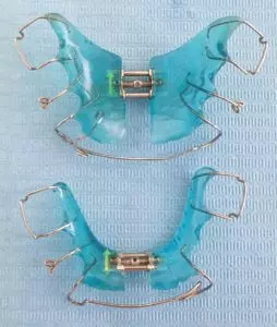 zdjęcie aparatów Schwarca druciki na zęby na sztucznych podniebieniach w kolorze niebieskim