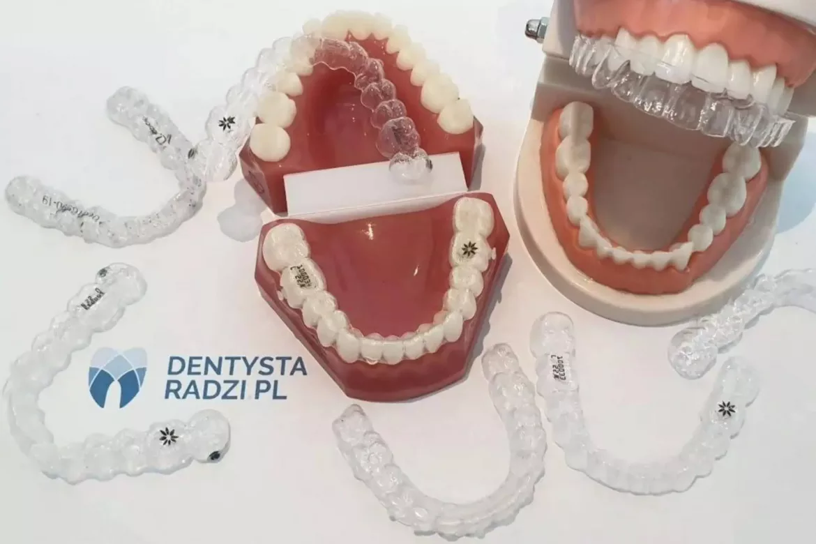 Nakładki prostujące na zęby różnych firm porozrzucane na stole wraz z dwoma modelami zebów na których też są przezroczyte nakładki na zęby