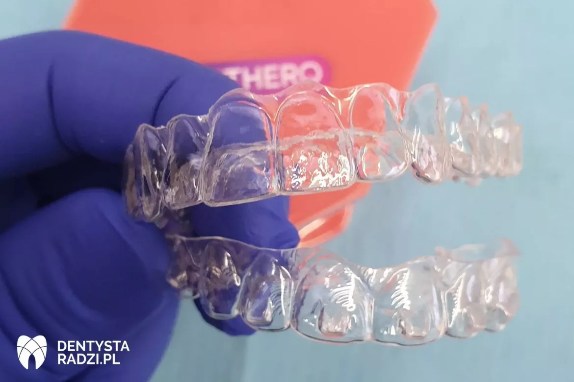 Ręka w niebieskiej rękawiczce trzyma dwie przezroczyste nakładki do prostowania zębów na tle modelu z zębami i logo Orthero.