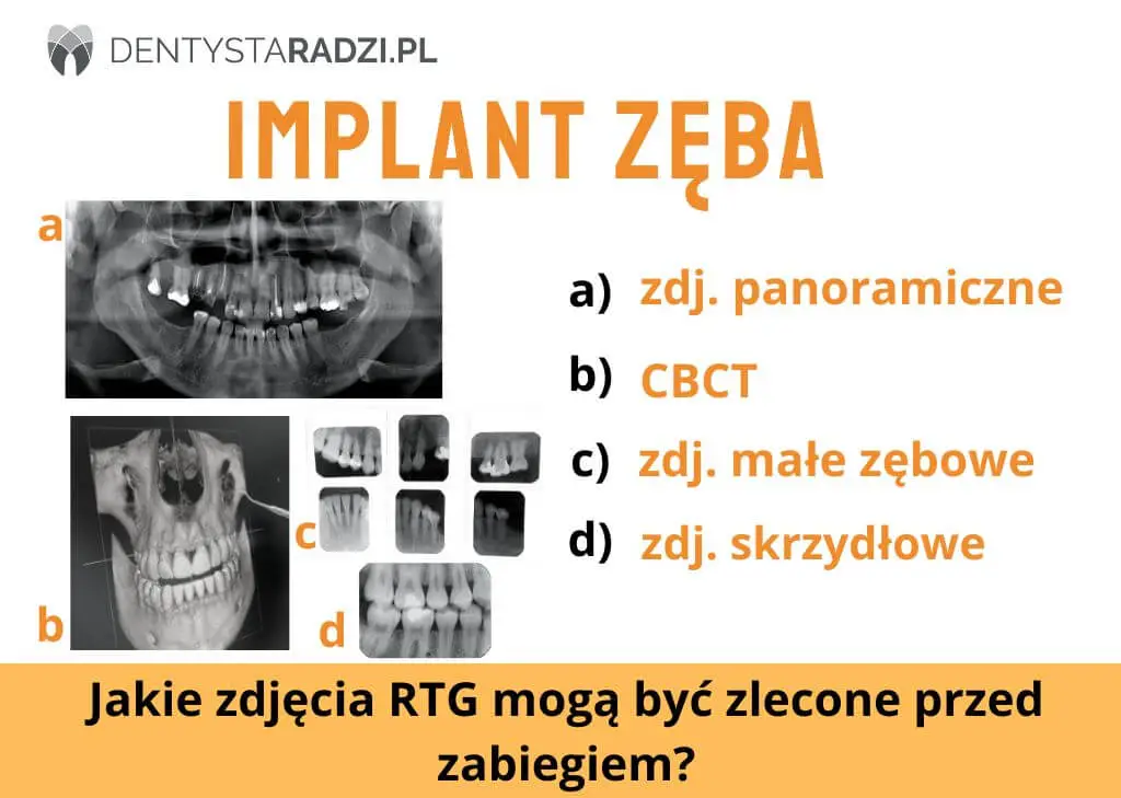 4 rodzaje zdjec radiologicznych rtg przed implantem jakie trzeba zrobic panoramiczne CBCT zebowe skrzydlowe