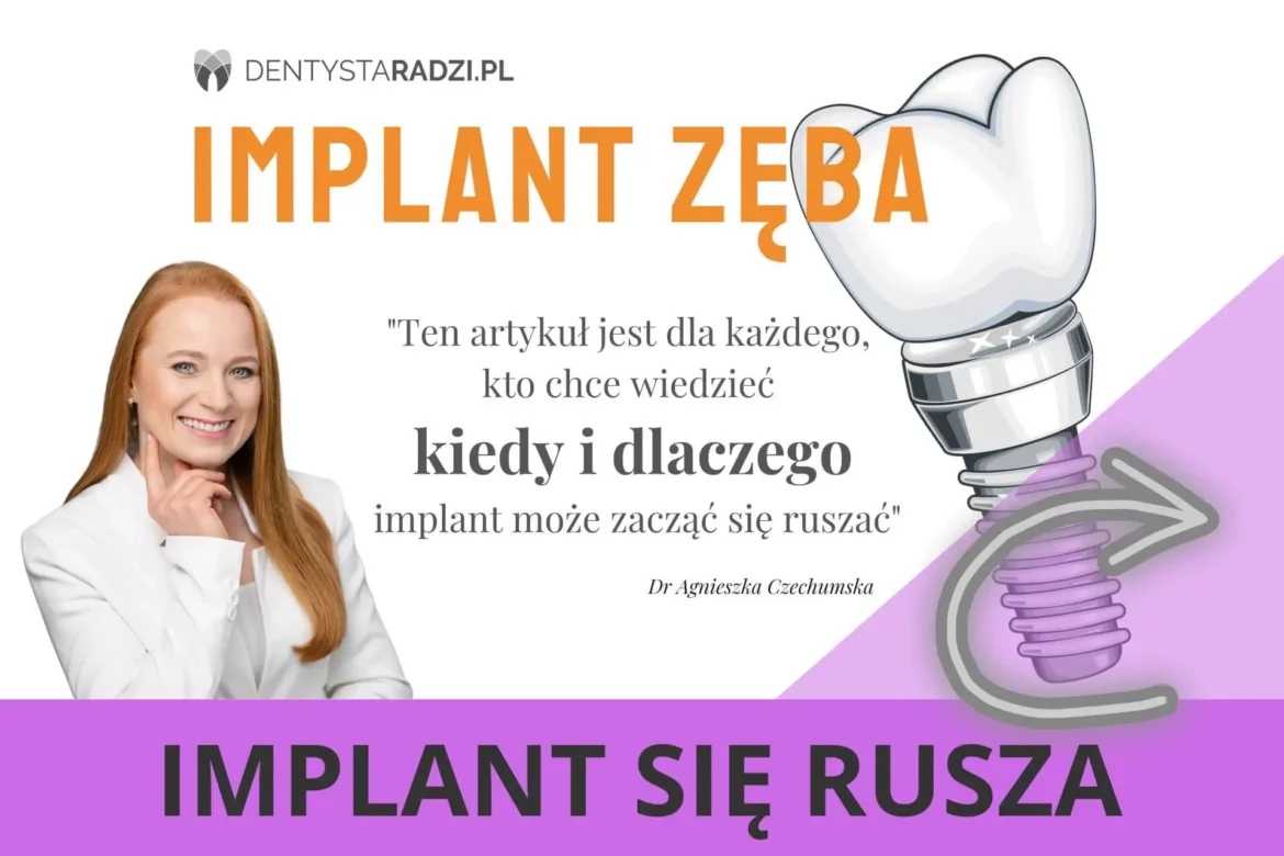 Ruszajacy sie implant zeba i napis implant sie rusza a obok dr Agnieszksa Czechumska