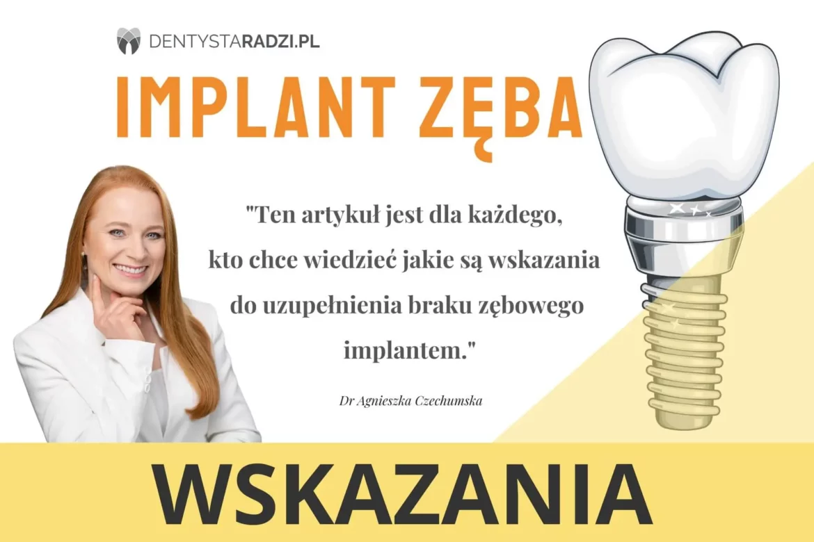 wskazania do Dr Agnieszka Czechumska uzupelnienie zeba implantu zeba implantologia