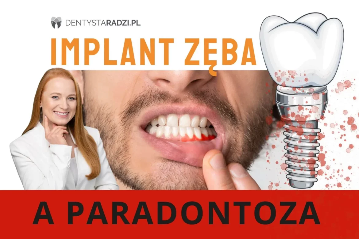 implant zeba i chore przyzebie dziaslo czyli paradontoza u pacjenta i dentysta na zdjeciu