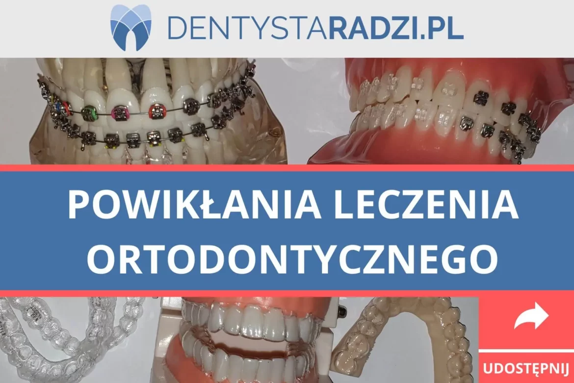 napis powiklania leczenia ortodontycznego i zdjecia aparatow stalych na zeby oraz przezroczystych nakladek ortodontycznych