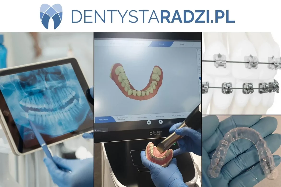 etapy leczenia ortodontycznego analiza zdjecia RTG skan zebow i aparat staly oraz nakladki prostujace na zeby