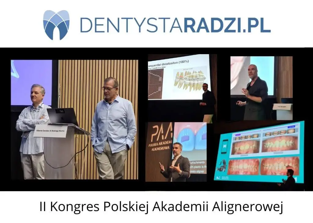 Zdjecia wykladowcow polskiej akademii alignerowej drugi kongres