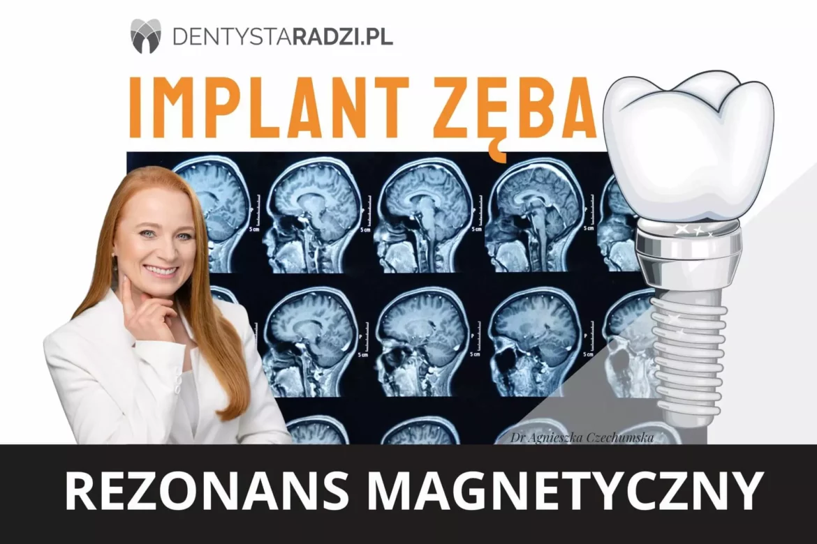 Zdjęcia głowy w rezonansie magnetycznym oraz implant zeba i dentysta