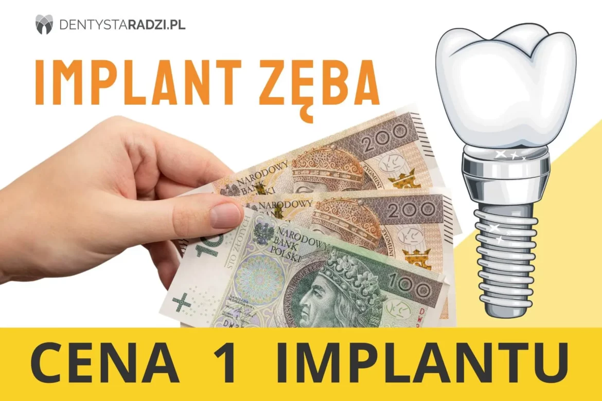 napis cena 1 jednego implantu i implant zeba i reka trzyma pieniadze na zaplacenie ceny wszczepienia implantu